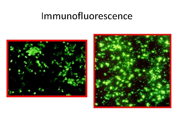 Immunofluorescence 