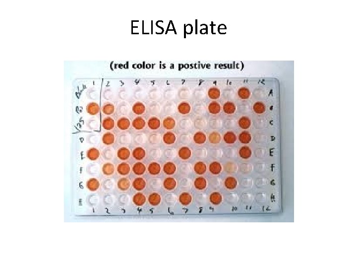 ELISA plate 