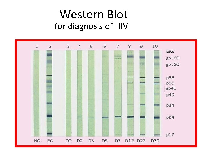 Western Blot for diagnosis of HIV 
