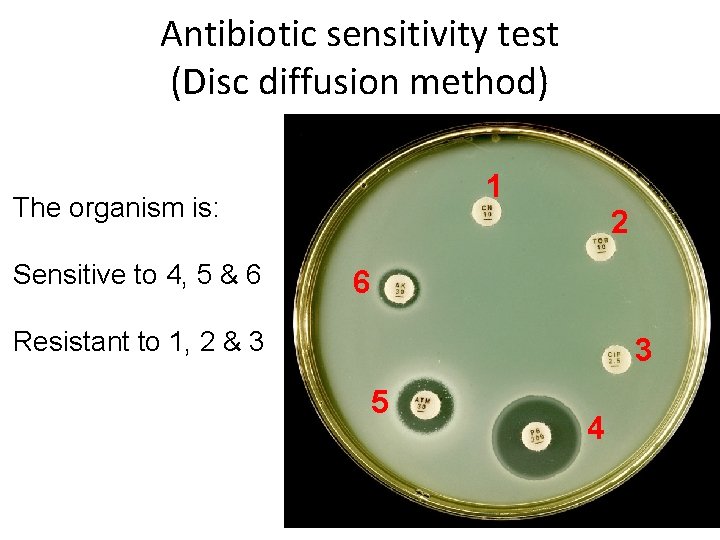 Antibiotic sensitivity test (Disc diffusion method) 1 The organism is: Sensitive to 4, 5