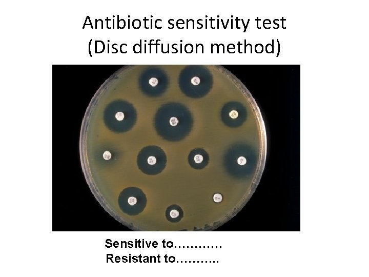 Antibiotic sensitivity test (Disc diffusion method) Sensitive to………… Resistant to………. . 