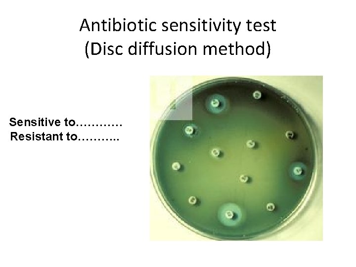 Antibiotic sensitivity test (Disc diffusion method) Sensitive to………… Resistant to………. . 