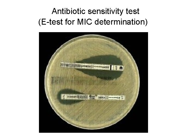 Antibiotic sensitivity test (E-test for MIC determination) 