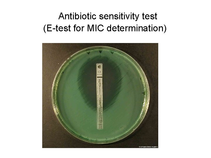 Antibiotic sensitivity test (E-test for MIC determination) 