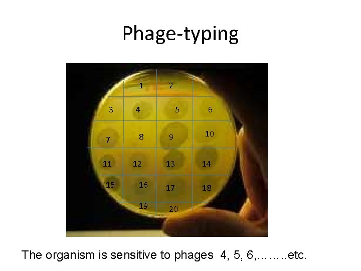Phage-typing 1 3 2 4 5 6 10 7 8 9 11 12 13