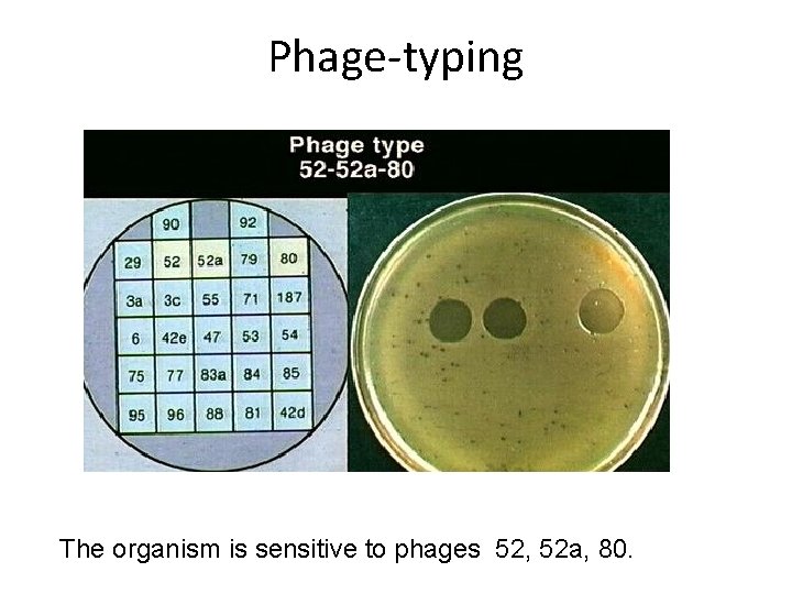 Phage-typing The organism is sensitive to phages 52, 52 a, 80. 