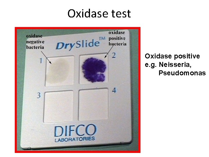 Oxidase test Oxidase positive e. g. Neisseria, Pseudomonas 