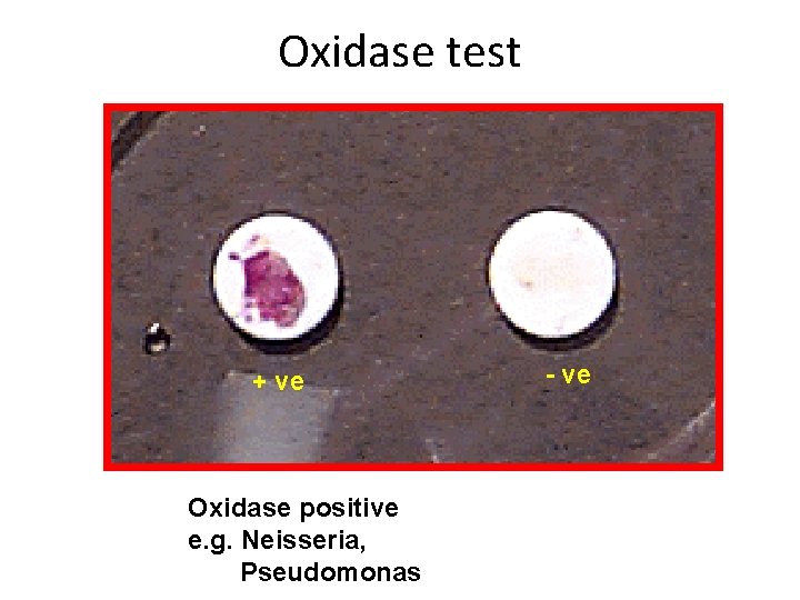 Oxidase test + ve Oxidase positive e. g. Neisseria, Pseudomonas - ve 