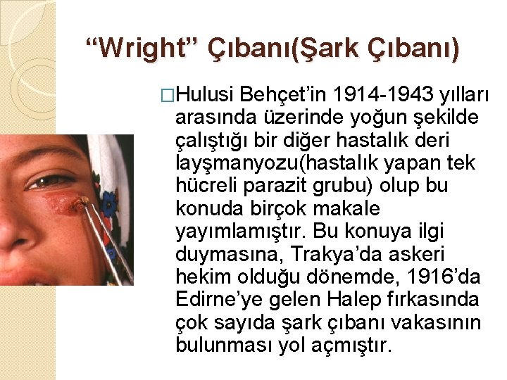 “Wright” Çıbanı(Şark Çıbanı) �Hulusi Behçet’in 1914 -1943 yılları arasında üzerinde yoğun şekilde çalıştığı bir