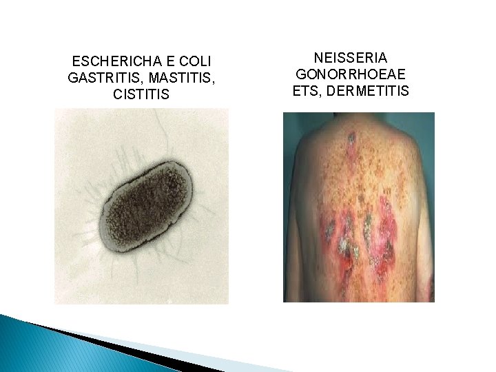 ESCHERICHA E COLI GASTRITIS, MASTITIS, CISTITIS NEISSERIA GONORRHOEAE ETS, DERMETITIS 