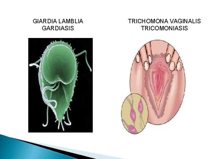 GIARDIA LAMBLIA GARDIASIS TRICHOMONA VAGINALIS TRICOMONIASIS 