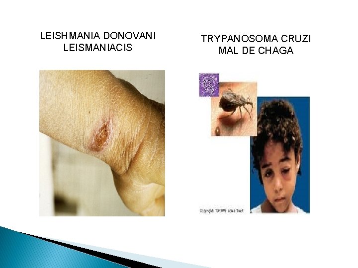 LEISHMANIA DONOVANI LEISMANIACIS TRYPANOSOMA CRUZI MAL DE CHAGA 