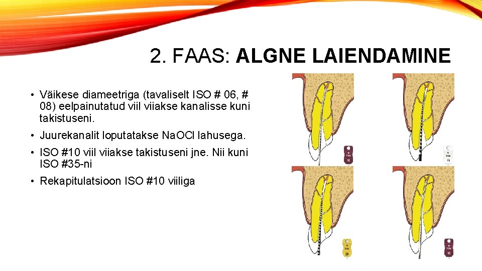 2. FAAS: ALGNE LAIENDAMINE • Väikese diameetriga (tavaliselt ISO # 06, # 08) eelpainutatud