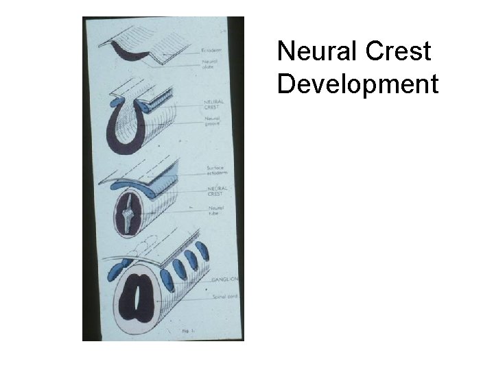 Neural Crest Development 