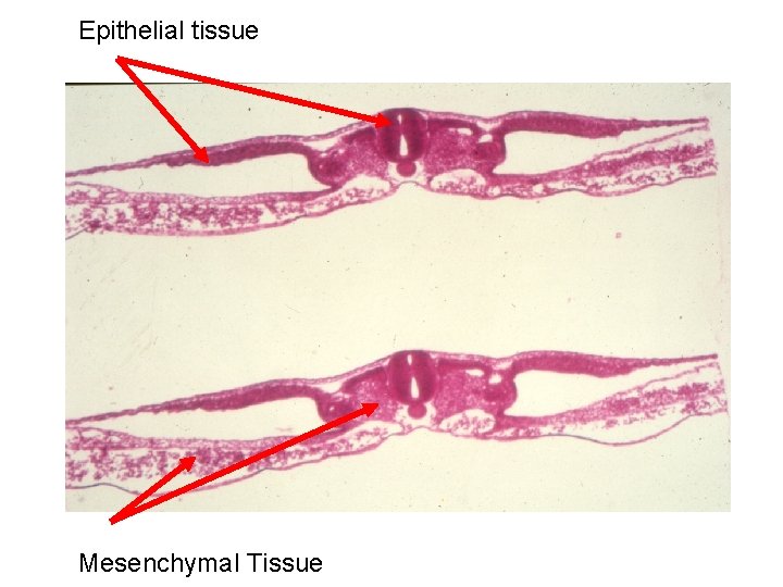 Epithelial tissue Mesenchymal Tissue 