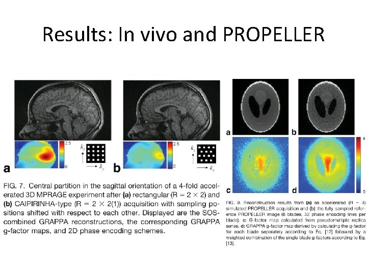 Results: In vivo and PROPELLER 