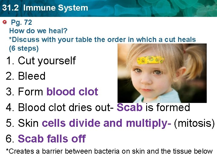 31. 2 Immune System Pg. 72 How do we heal? *Discuss with your table