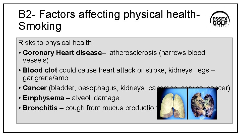 B 2 - Factors affecting physical health. Smoking Risks to physical health: • Coronary