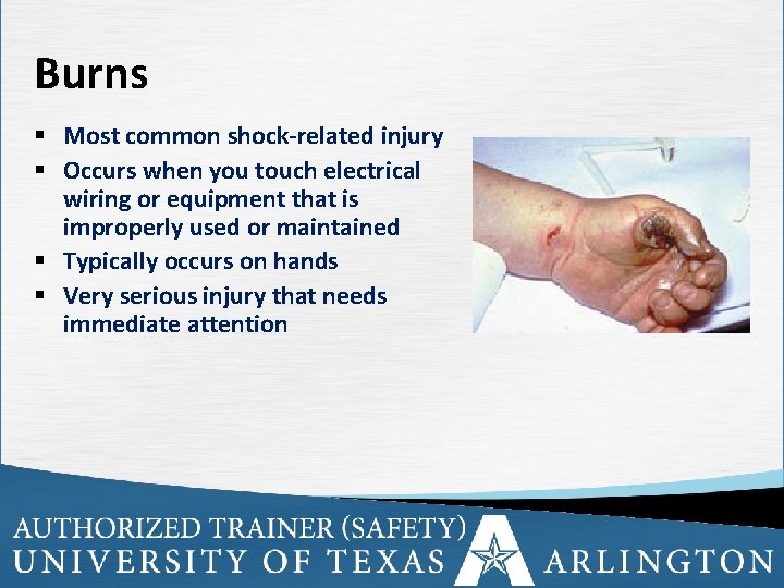 Burns § Most common shock-related injury § Occurs when you touch electrical wiring or