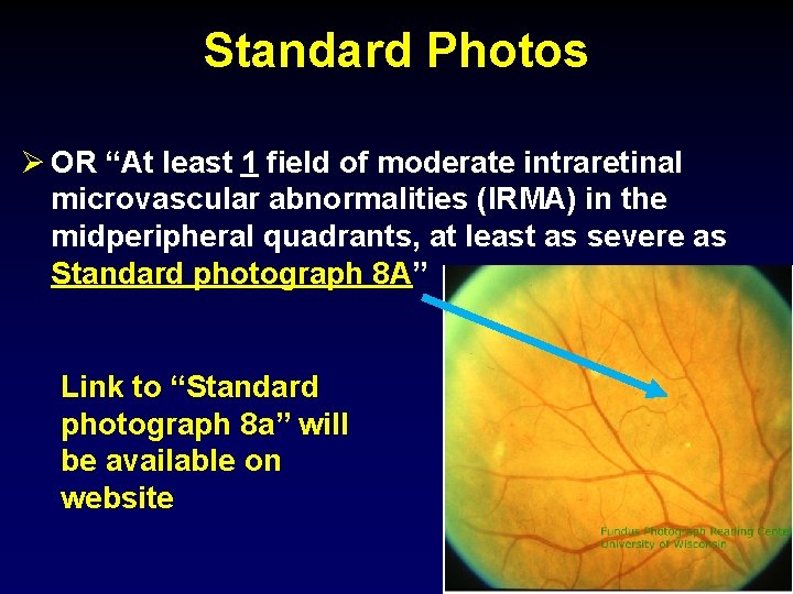 Standard Photos Ø OR “At least 1 field of moderate intraretinal microvascular abnormalities (IRMA)