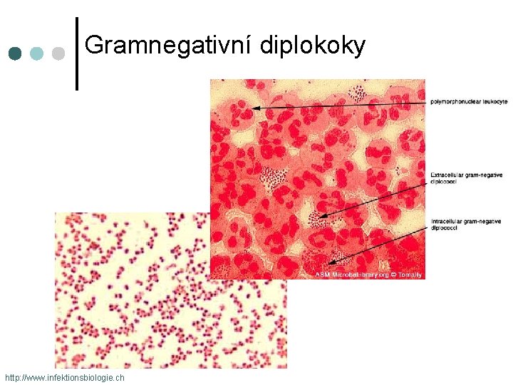 Gramnegativní diplokoky http: //www. infektionsbiologie. ch 