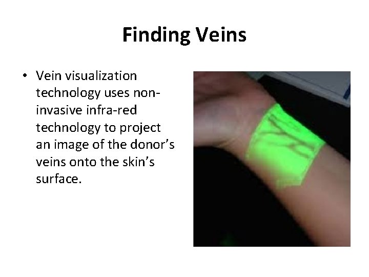 Finding Veins • Vein visualization technology uses noninvasive infra-red technology to project an image