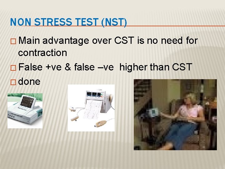 NON STRESS TEST (NST) � Main advantage over CST is no need for contraction