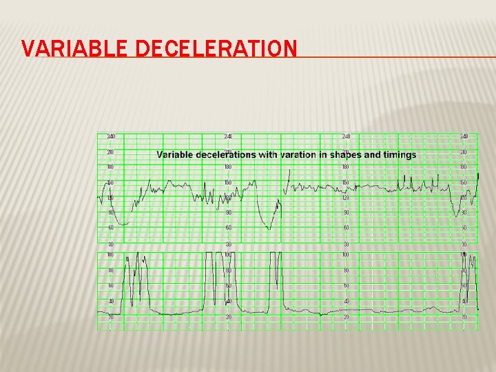 VARIABLE DECELERATION 