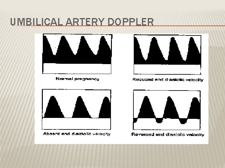 UMBILICAL ARTERY DOPPLER 