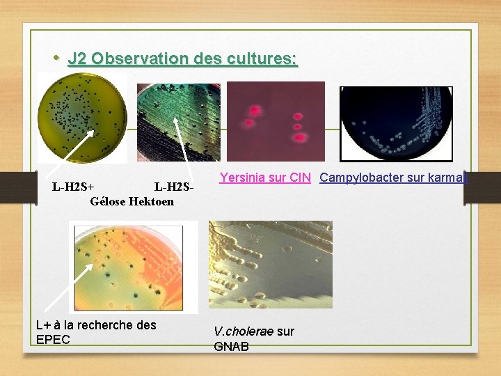  • J 2 Observation des cultures: L-H 2 S+ L-H 2 SGélose Hektoen