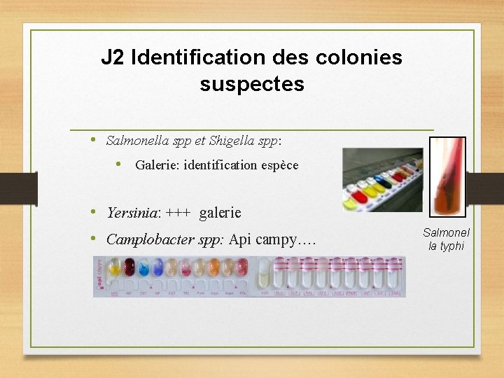 J 2 Identification des colonies suspectes • Salmonella spp et Shigella spp: • Galerie: