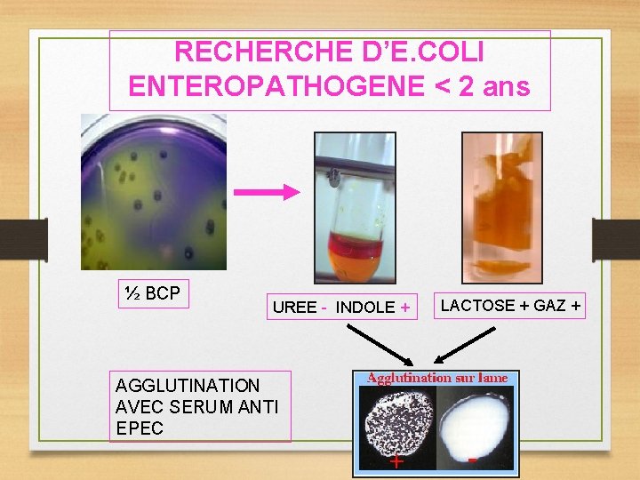 RECHERCHE D’E. COLI ENTEROPATHOGENE < 2 ans ½ BCP UREE - INDOLE + AGGLUTINATION