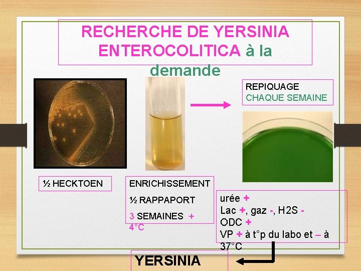 RECHERCHE DE YERSINIA ENTEROCOLITICA à la demande REPIQUAGE CHAQUE SEMAINE ½ HECKTOEN ENRICHISSEMENT ½