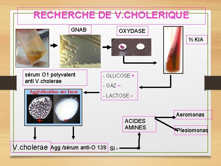 RECHERCHE DE V. CHOLERIQUE GNAB OXYDASE ½ KIA sérum O 1 polyvalent anti V.