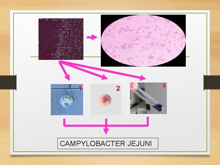 CAMPYLOBACTER JEJUNI 