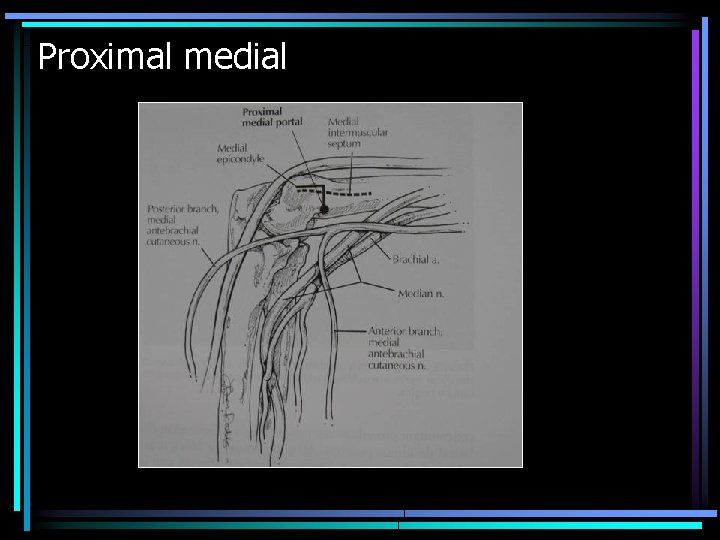 Proximal medial 
