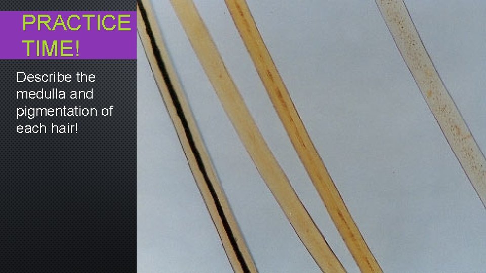 PRACTICE TIME! Describe the medulla and pigmentation of each hair! 