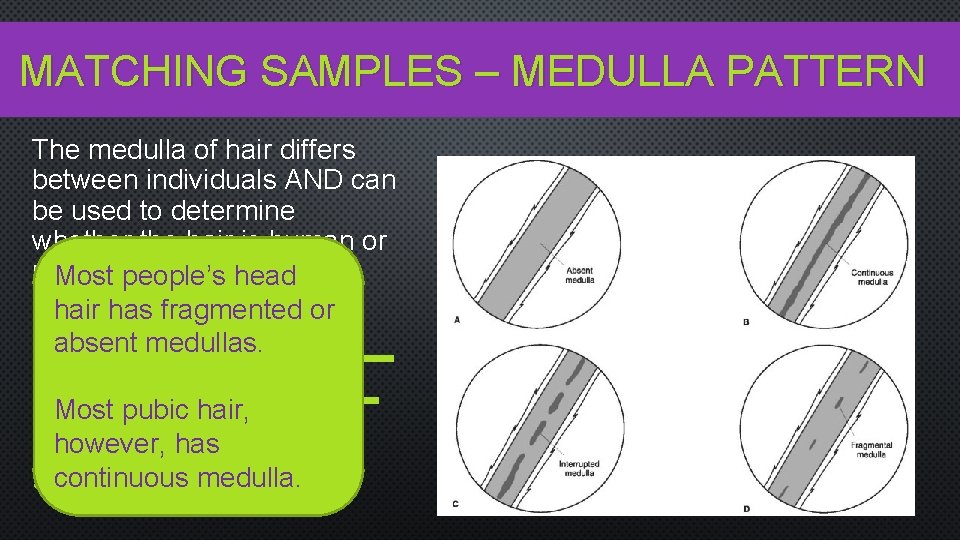 MATCHING SAMPLES – MEDULLA PATTERN The medulla of hair differs between individuals AND can