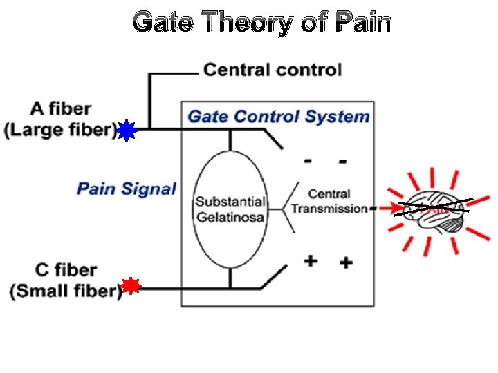 Gate Theory of Pain 