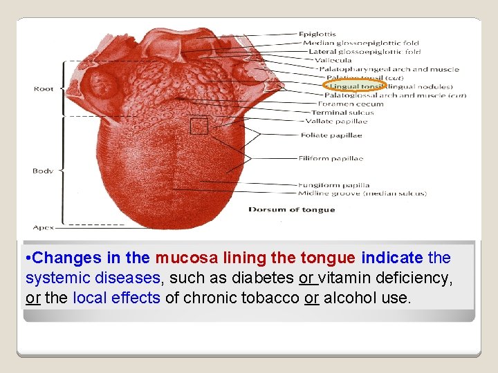  • Changes in the mucosa lining the tongue indicate the systemic diseases, such