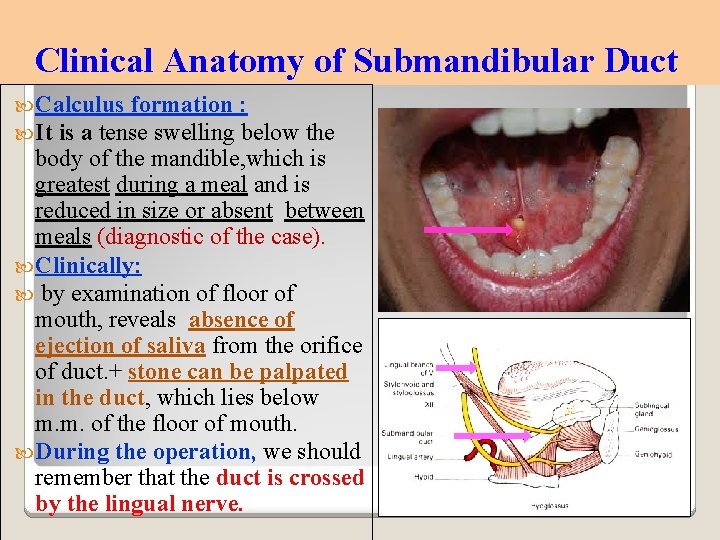 Clinical Anatomy of Submandibular Duct Calculus formation : It is a tense swelling below