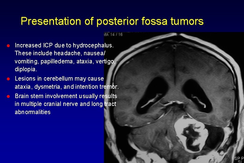 Presentation of posterior fossa tumors l Increased ICP due to hydrocephalus. These include headache,