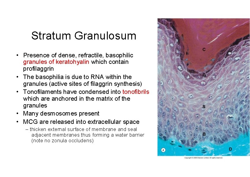 Stratum Granulosum • Presence of dense, refractile, basophilic granules of keratohyalin which contain profilaggrin