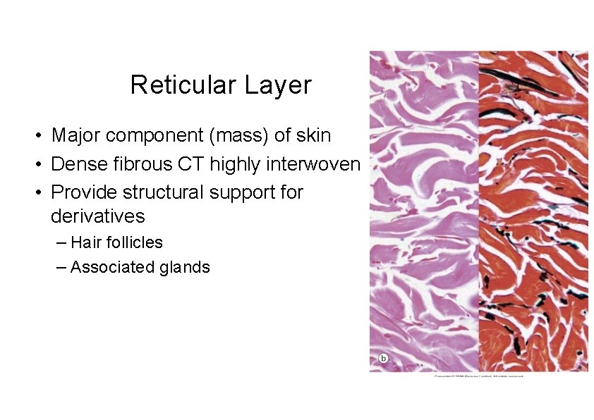 Reticular Layer • Major component (mass) of skin • Dense fibrous CT highly interwoven