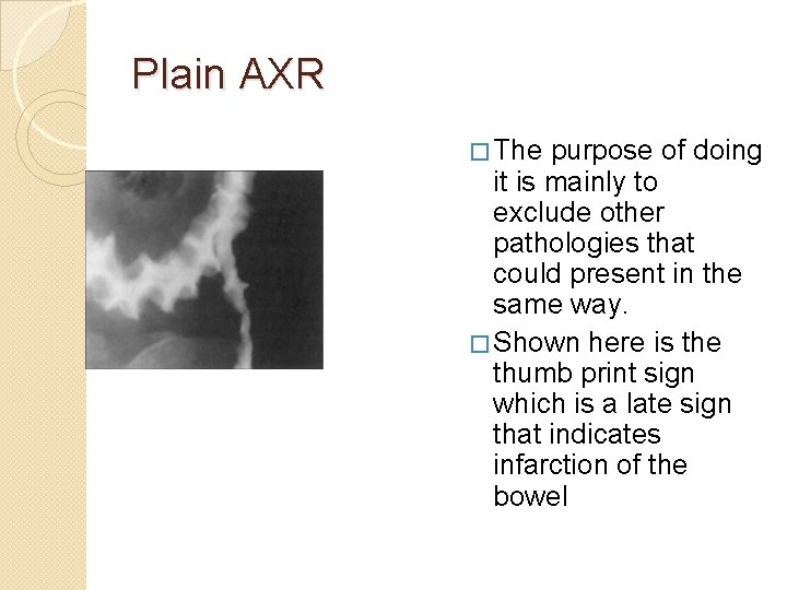 Plain AXR � The purpose of doing it is mainly to exclude other pathologies