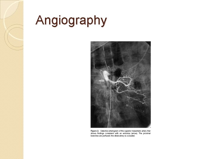 Angiography 
