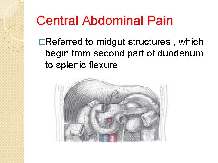 Central Abdominal Pain �Referred to midgut structures , which begin from second part of
