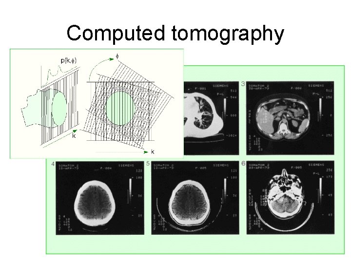 Computed tomography Computed tomography