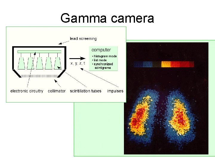 Gamma camera Gamma camera