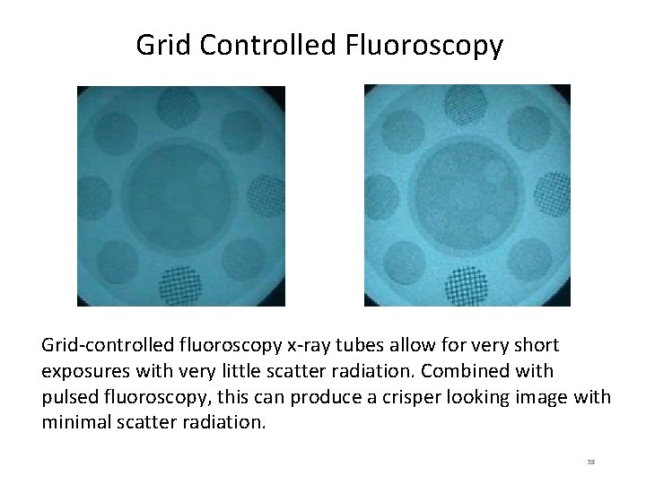 Grid Controlled Fluoroscopy Grid-controlled fluoroscopy x-ray tubes allow for very short exposures with very